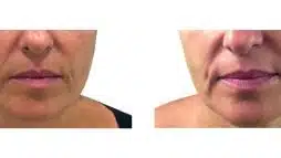 מיזם חדש (12)